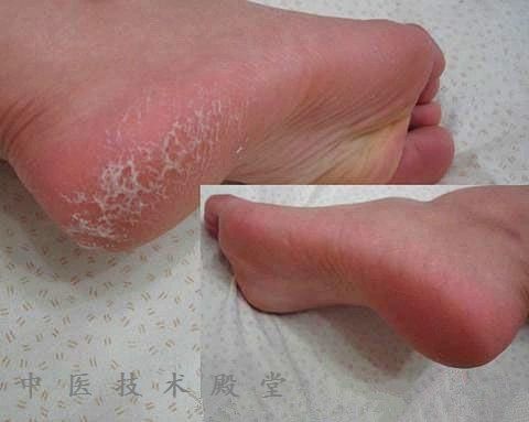 奇特的生活秘方