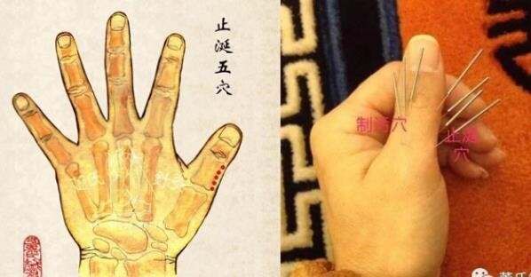 董针——眼科处方