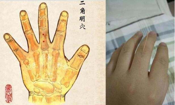 董针——眼科处方