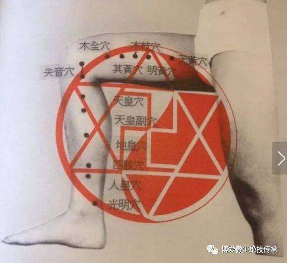 董针——眼科处方