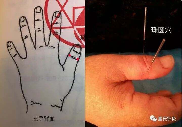 董针——眼科处方