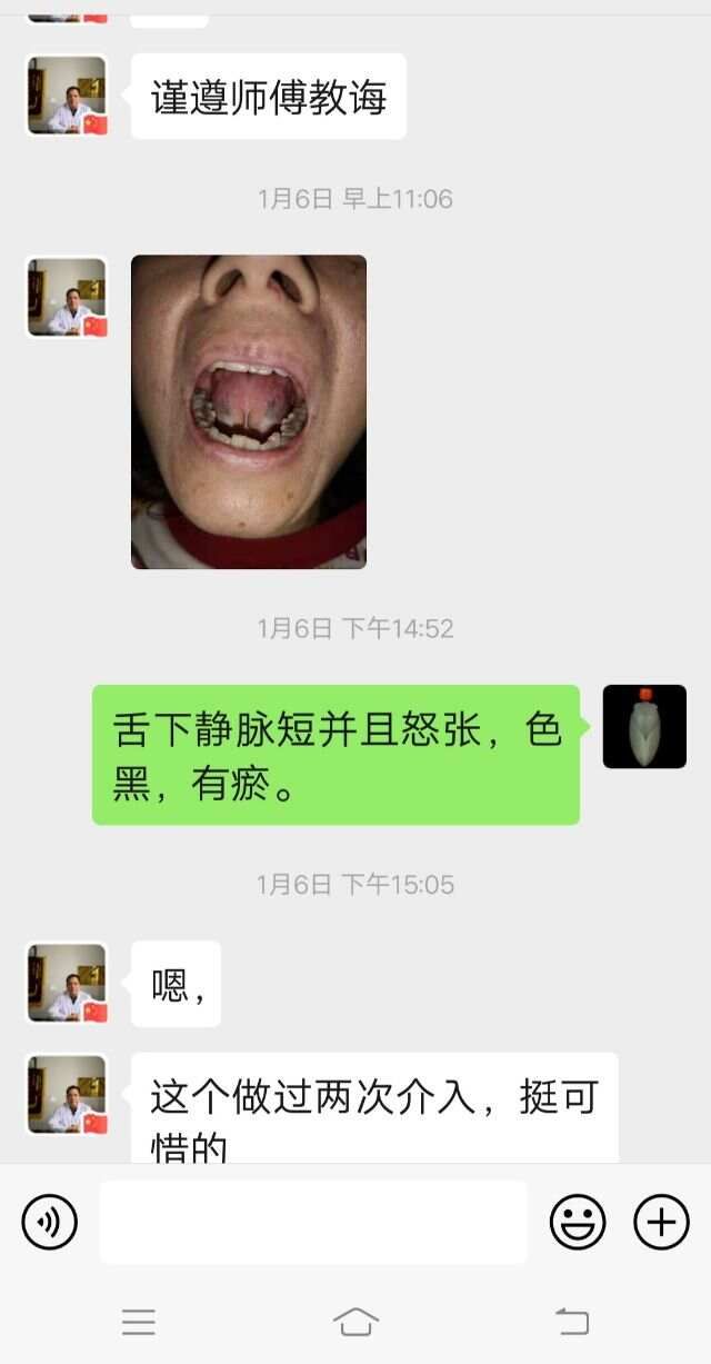 中医有四大顽疾：风，劳，臌，膈*肝腹水(肖春宏老师)