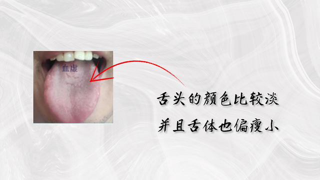 舌头有裂纹就是肾精亏虚教你认识4种裂纹舌