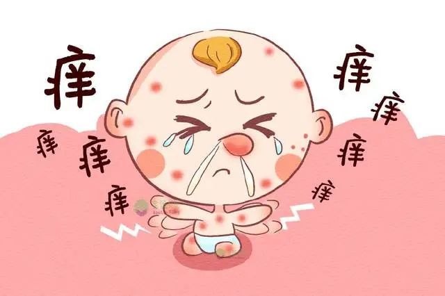 皮肤课冬天也难逃“蚊子包”你需要一份荨麻疹用药和预防全
