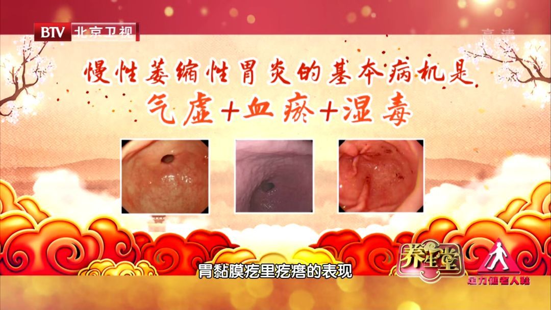 胃痛不在意当心养成癌！两参加一粥，分清证型调脾胃，逆转癌前