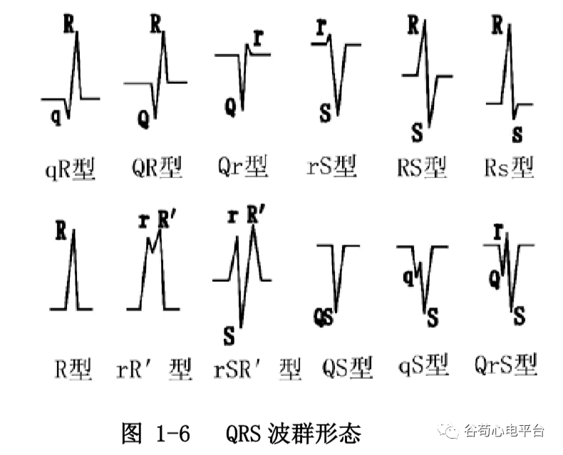 盘点正常心电图波形及各波的临床意义，收藏起来！
