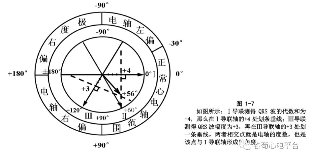 盘点正常心电图波形及各波的临床意义，收藏起来！