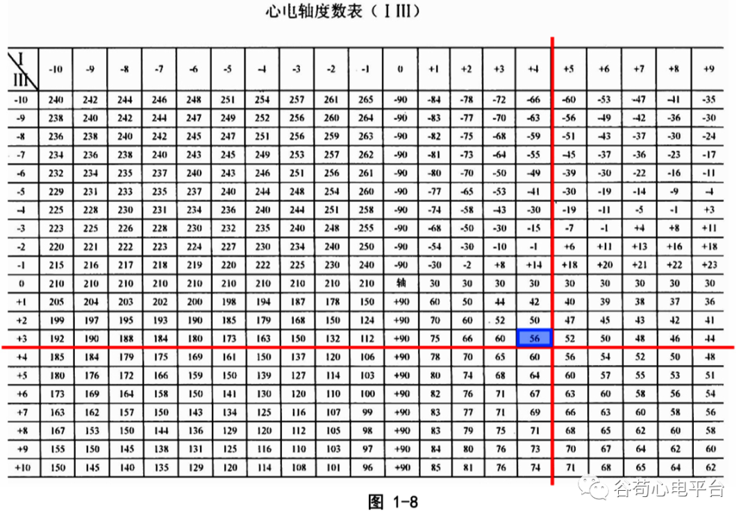 盘点正常心电图波形及各波的临床意义，收藏起来！