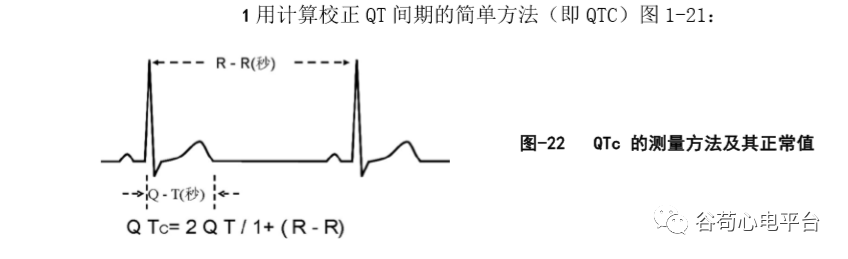 盘点正常心电图波形及各波的临床意义，收藏起来！