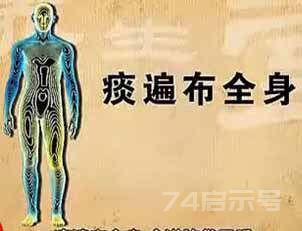 《病从脾胃生》5、痰邪，自测体内痰邪法、“二陈丸”、寒痰“小青