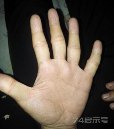 讲“手相”终极篇（二十五）