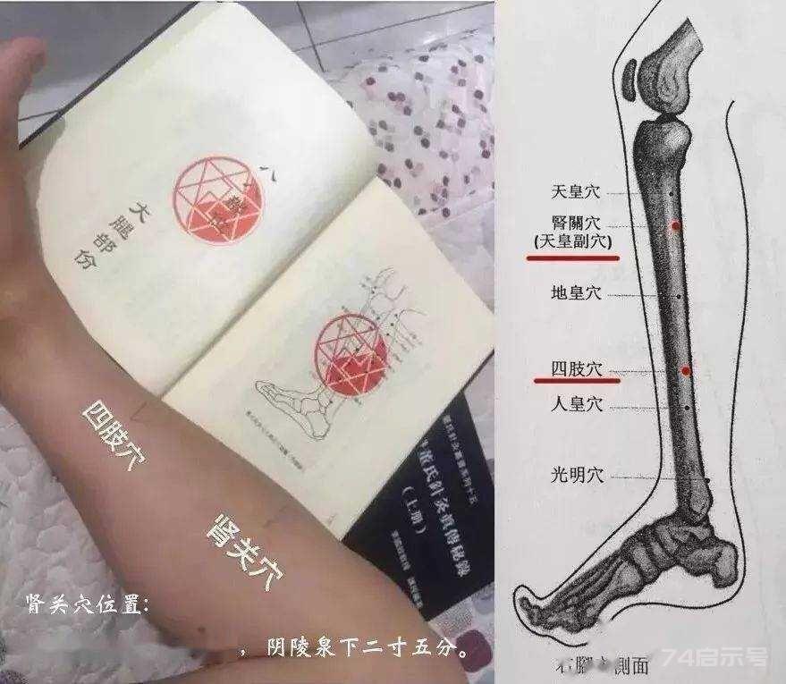 立竿见影的董氏奇穴针灸绝招