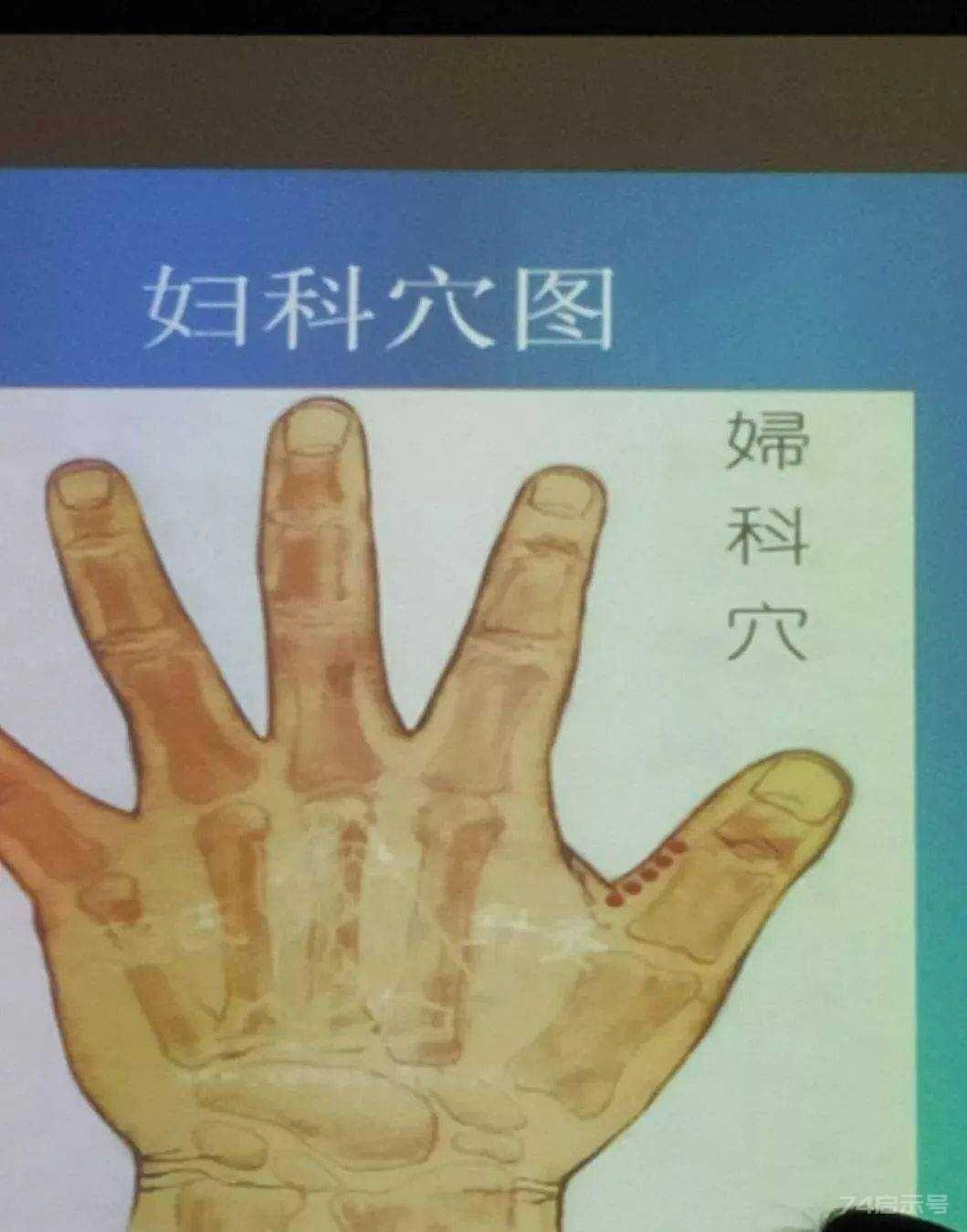 立竿见影的董氏奇穴针灸绝招