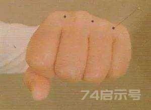 立竿见影的董氏奇穴针灸绝招