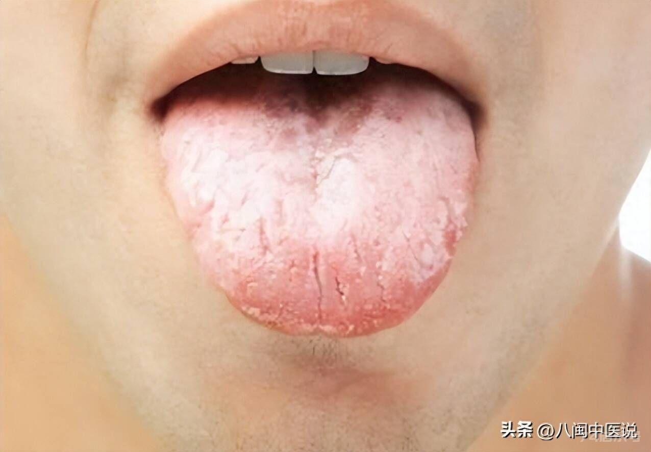 “人有三黄，寿命不长”，三黄是什么如何对抗三黄，中医全讲了