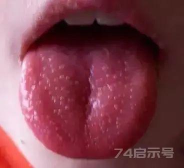 秋冬交替的时节，阴虚的人该如何养阴呢