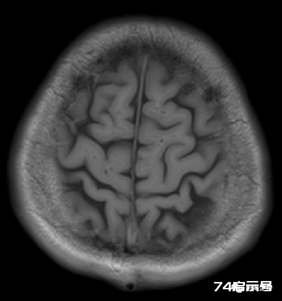 人手一册史上最详细的高清头颅MR解剖