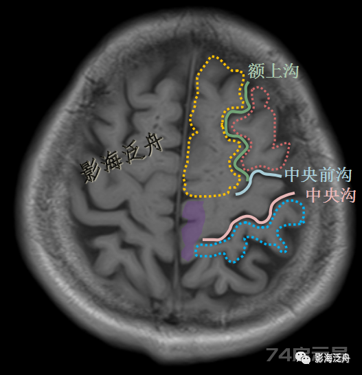 人手一册史上最详细的高清头颅MR解剖