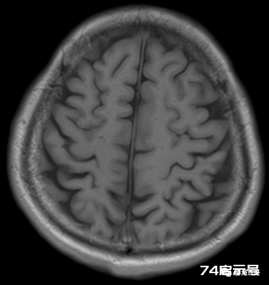 人手一册史上最详细的高清头颅MR解剖
