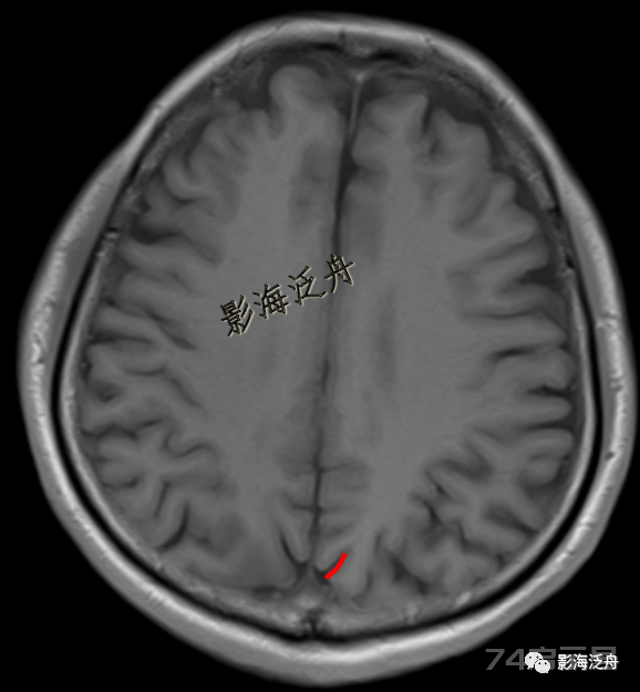 人手一册史上最详细的高清头颅MR解剖