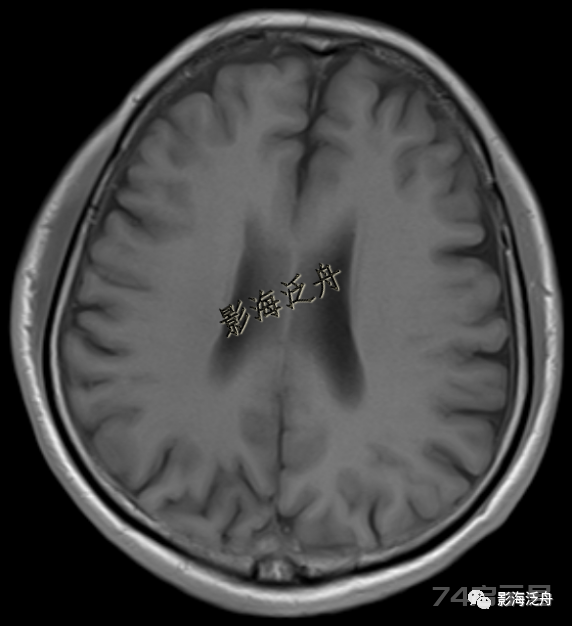 人手一册史上最详细的高清头颅MR解剖