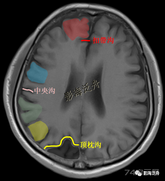 人手一册史上最详细的高清头颅MR解剖