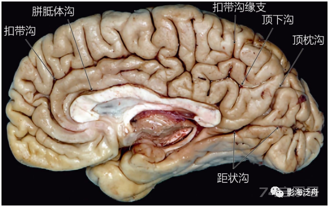 人手一册史上最详细的高清头颅MR解剖
