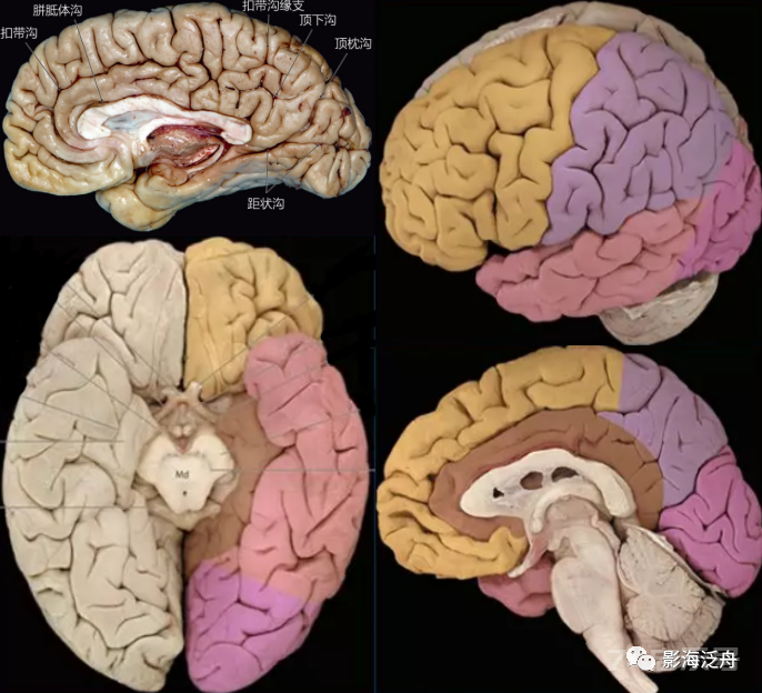 人手一册史上最详细的高清头颅MR解剖