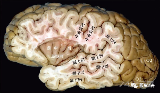 人手一册史上最详细的高清头颅MR解剖