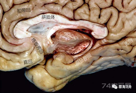 人手一册史上最详细的高清头颅MR解剖