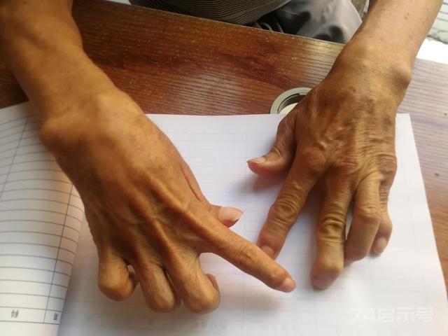 五淫痹中寒痹的中医辨证治疗