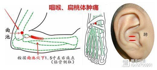 宣宾：部位选讲——尺泽与曲池_宣宾：部位选讲——尺泽与曲池_