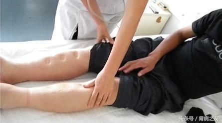 脸肿、眼肿、脚肿、腿肿、肚子肿、内脏肿……快来看你的水肿是什么病？