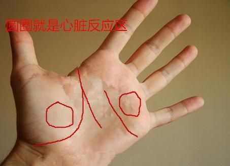 看手相了解心脏疾病 请收藏