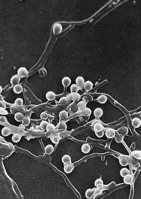放线菌菌丝可分为三种