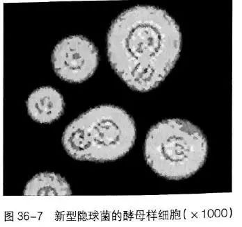 菌丝和孢子阳性严重吗_菌丝_菌丝图片