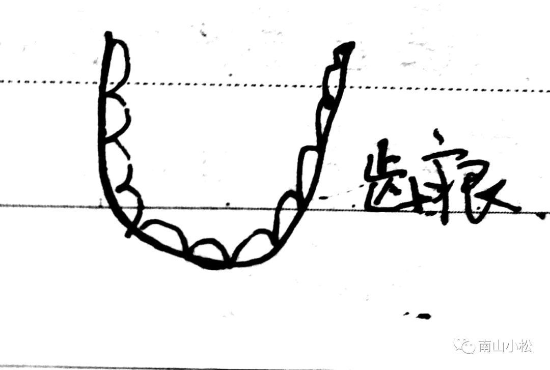 伤寒论44：蜜煎导法、土瓜根、大猪胆汁、桂枝汤、麻黄汤、茵陈蒿__伤寒论44：蜜煎导法、土瓜根、大猪胆汁、桂枝汤、麻黄汤、茵陈蒿