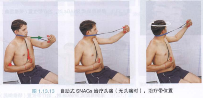 颈性头痛怎么引起的吗_颈型头痛_