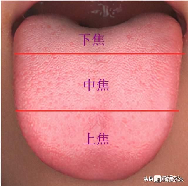舌尖塌陷中医__舌尖凹陷的医治