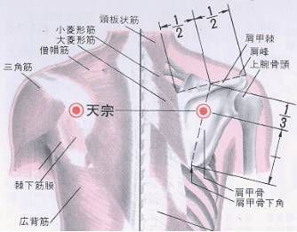 不为人知的天宗穴与上臂痛的秘密__不为人知的天宗穴与上臂痛的秘密