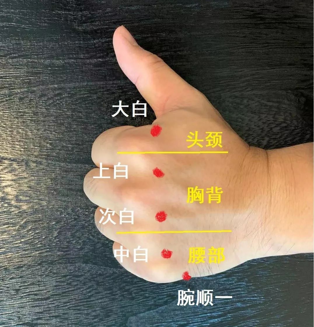 董氏全息针法__董针全息针法