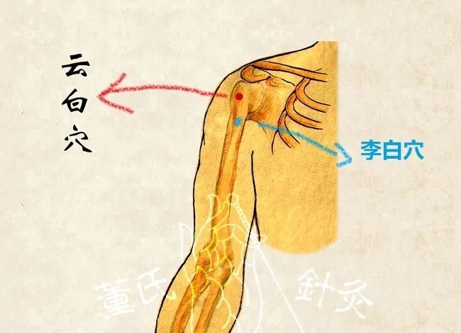 董氏落枕__落枕董针