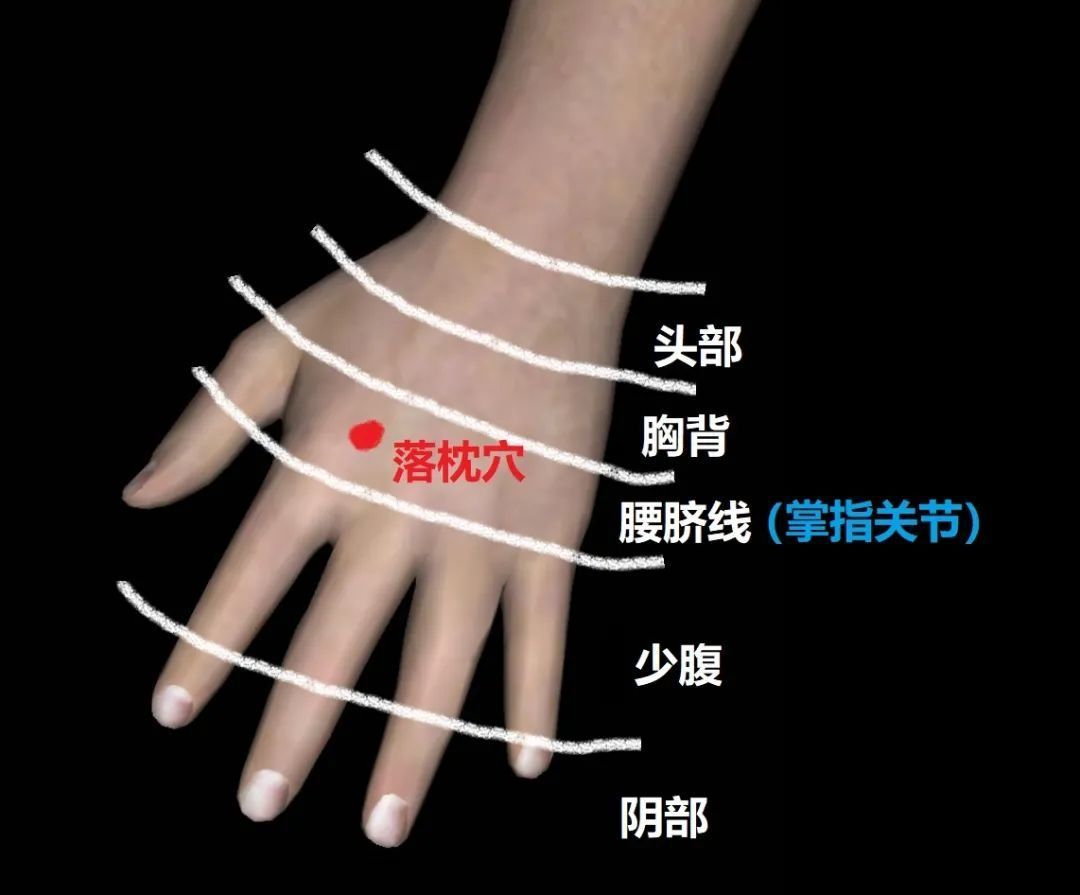 落枕董针_董氏落枕_
