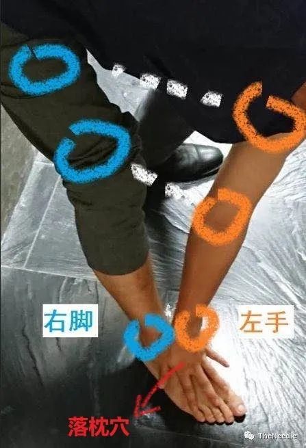 董氏落枕_落枕董针_