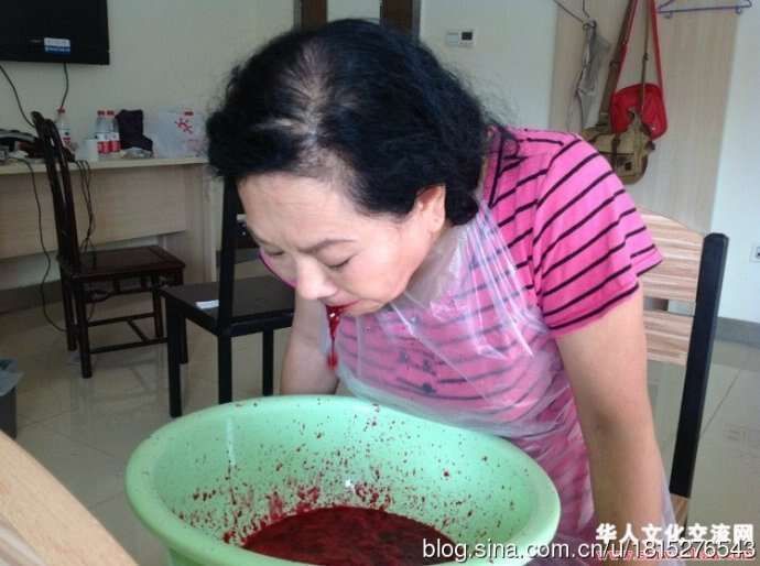 [转载]舌下静脉和肛门静脉的对应关系
