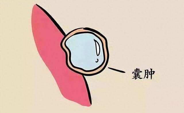 _肾结晶中药治疗_肾结晶中药方剂
