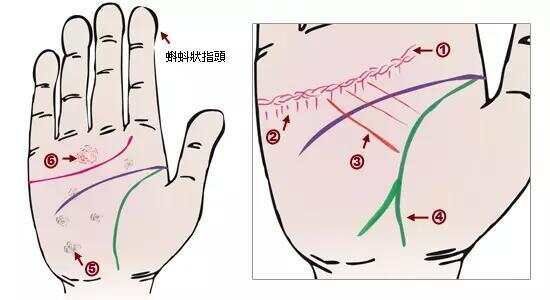 中医身心医学__中医与身心健康是什么课程
