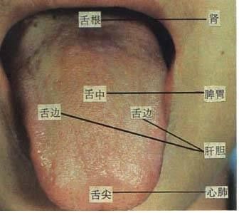 UC头条：[收藏]61张高清舌诊图谱, 图文对照
