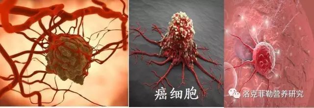 _癌症营养过剩_癌症是长期缺乏营养导致