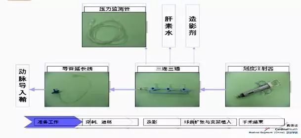 造影程序__造影流程以及注意事项